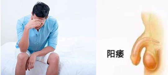 使用人群 使用人群