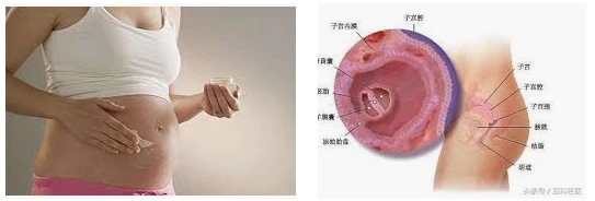 202003051583375893862404.jpg 威而鋼助孕